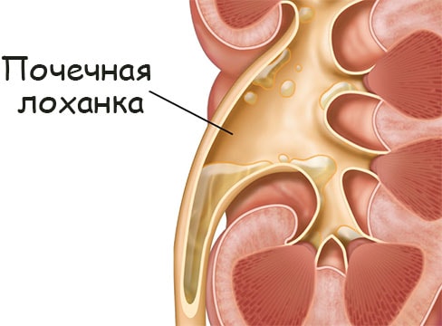 Кракен at